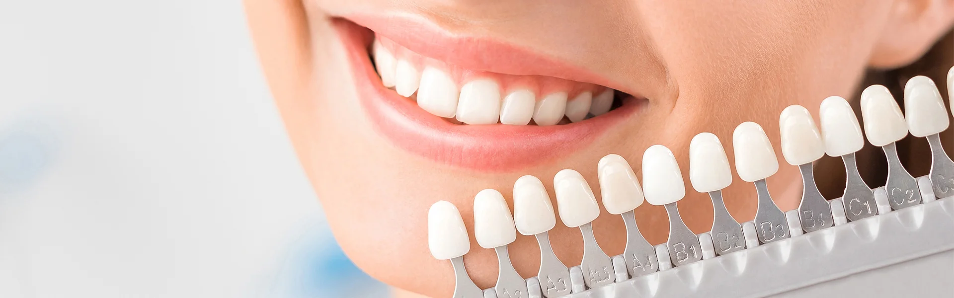 Can Veneers Replace Multiple Cosmetic Procedures?